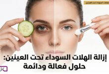 الدليل الشامل للتخلص من الهالات السوداء