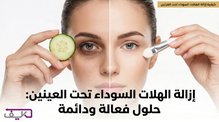 الدليل الشامل للتخلص من الهالات السوداء