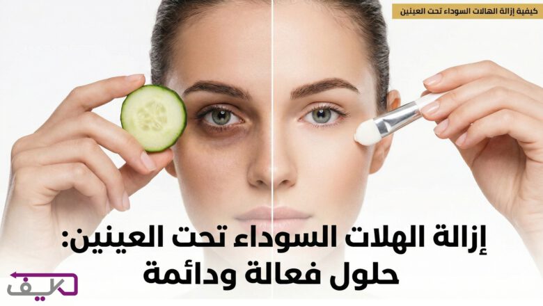الدليل الشامل للتخلص من الهالات السوداء